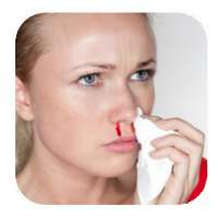 Nose Bleeding Remedies on 9Apps