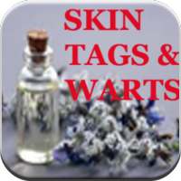 Remove Skin Tags & Warts on 9Apps